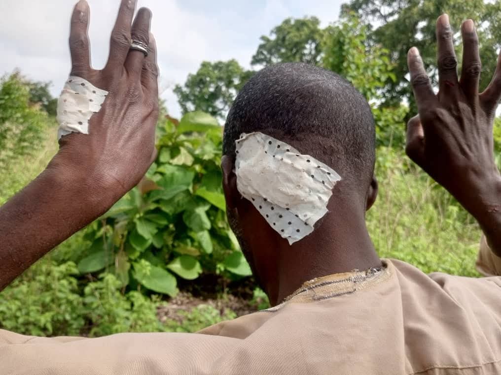 Sinendé : Nouvelle attaque nocturne à Diadia, un couple d’éleveurs agressé